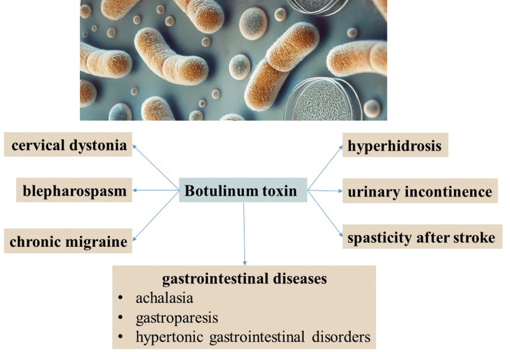 健康・医学 Botulinum Toxins: Clinical Applications Botulinum Toxins: Cosmetic and Clinical Applications